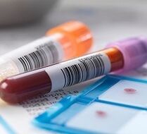 Laboratoriumdiagnose van prostatitis