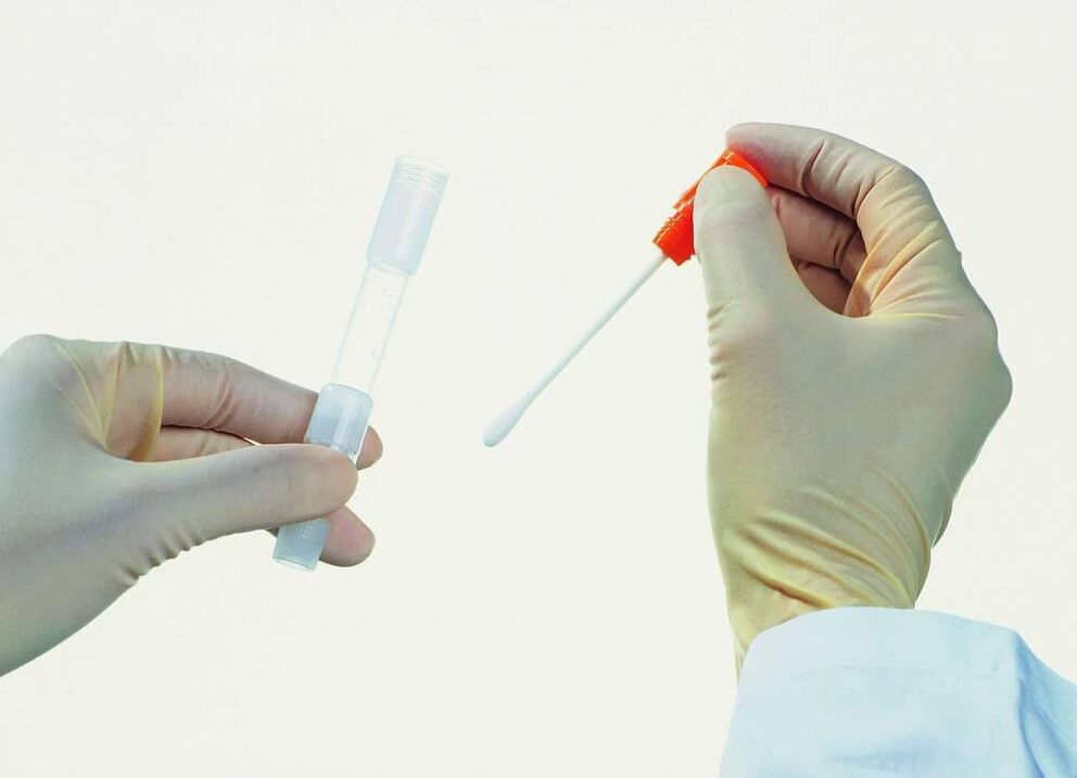 Analyse verzameling om chronische prostatitis te detecteren