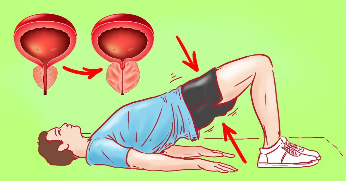Therapeutische oefeningen voor chronische prostatitis