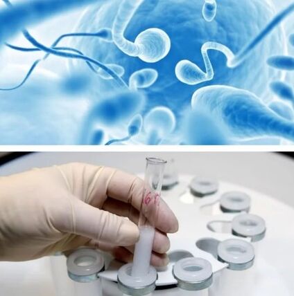 Spermagram