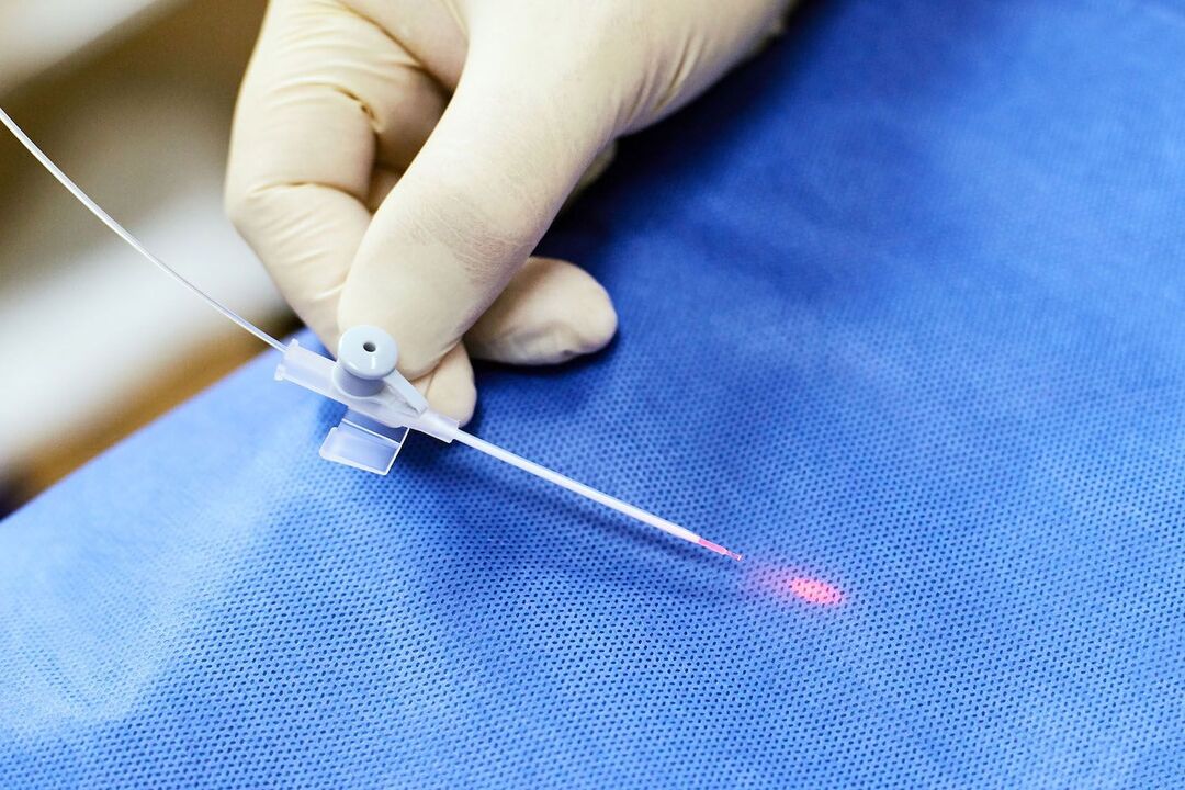 transrectaal apparaat voor prostaatbehandeling